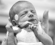 Santaros klinikose neišnešiotiems kūdikiams kraują tirs inovatyviu būdu be adatų