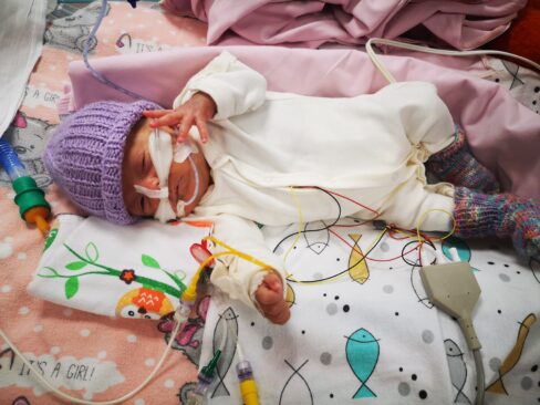 Ankstukės Iglės mama Dovilė: „Kad ir kas nutiktų – reikia tikėti savo vaiku“