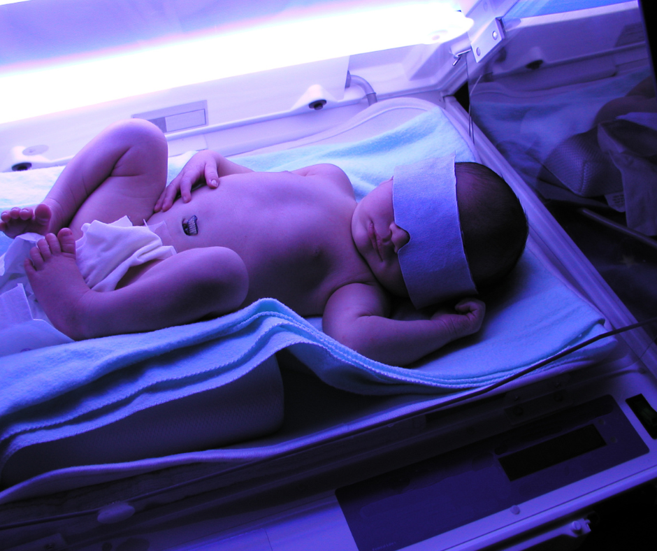 Fototerapijos lop&scaron;ys ankstukams